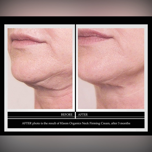 KLEEM ORGANICS NECK FIRMING CREAM
To stimulate collagen and lift skin - Picture 6 of 7